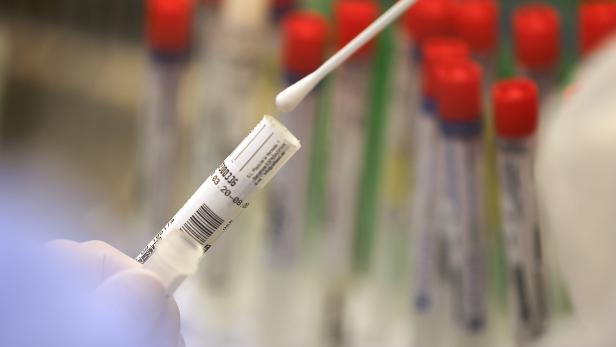 Von der DNA zum Krankheitsbild: Wie KI-Systeme das Diagnoseverfahren ändern Von der DNA zum Krankheitsbild: Wie KI-Systeme das Diagnoseverfahren ändern